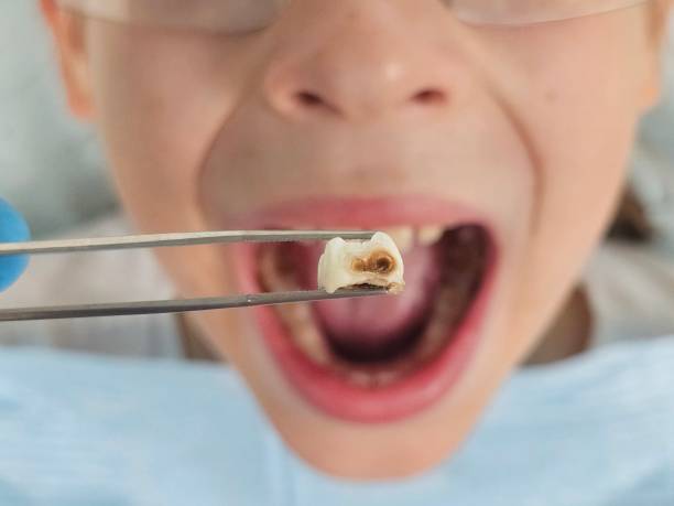 Best Emergency Denture Repair in Mcalester, OK
